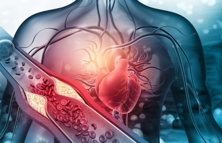 ارتفاع ضغط الدم: الأعراض الصامتة وكيف تحمي قلبك